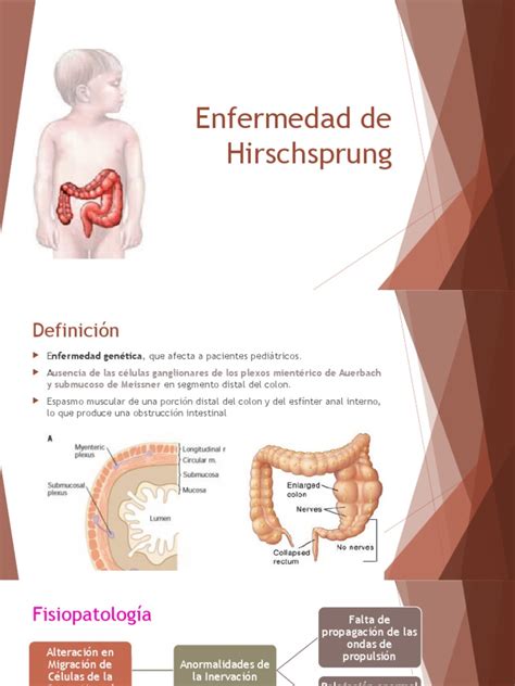 enfermedad de hirschsprung-4